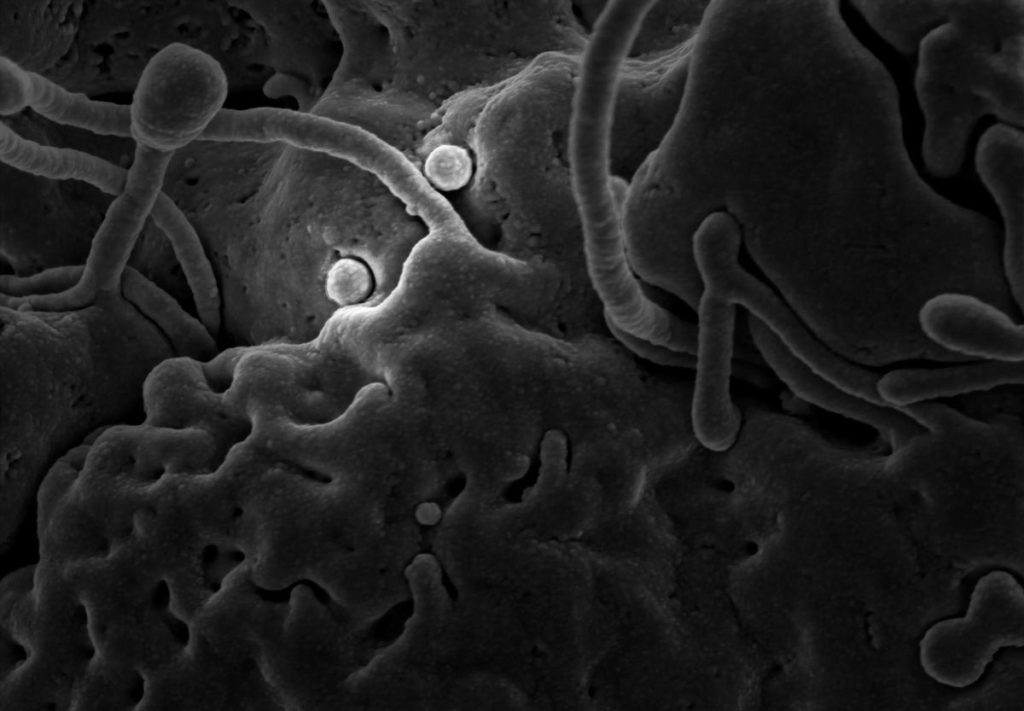 Coronavirus as portrayed by the CDC